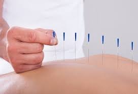  BASIC CERTIFICATION IN ACUPUNCTURE EDUCATION